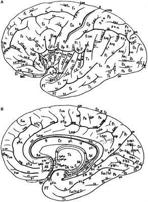 Toward a Common Terminology for the Gyri and Sulci of the Human Cerebral Cortex